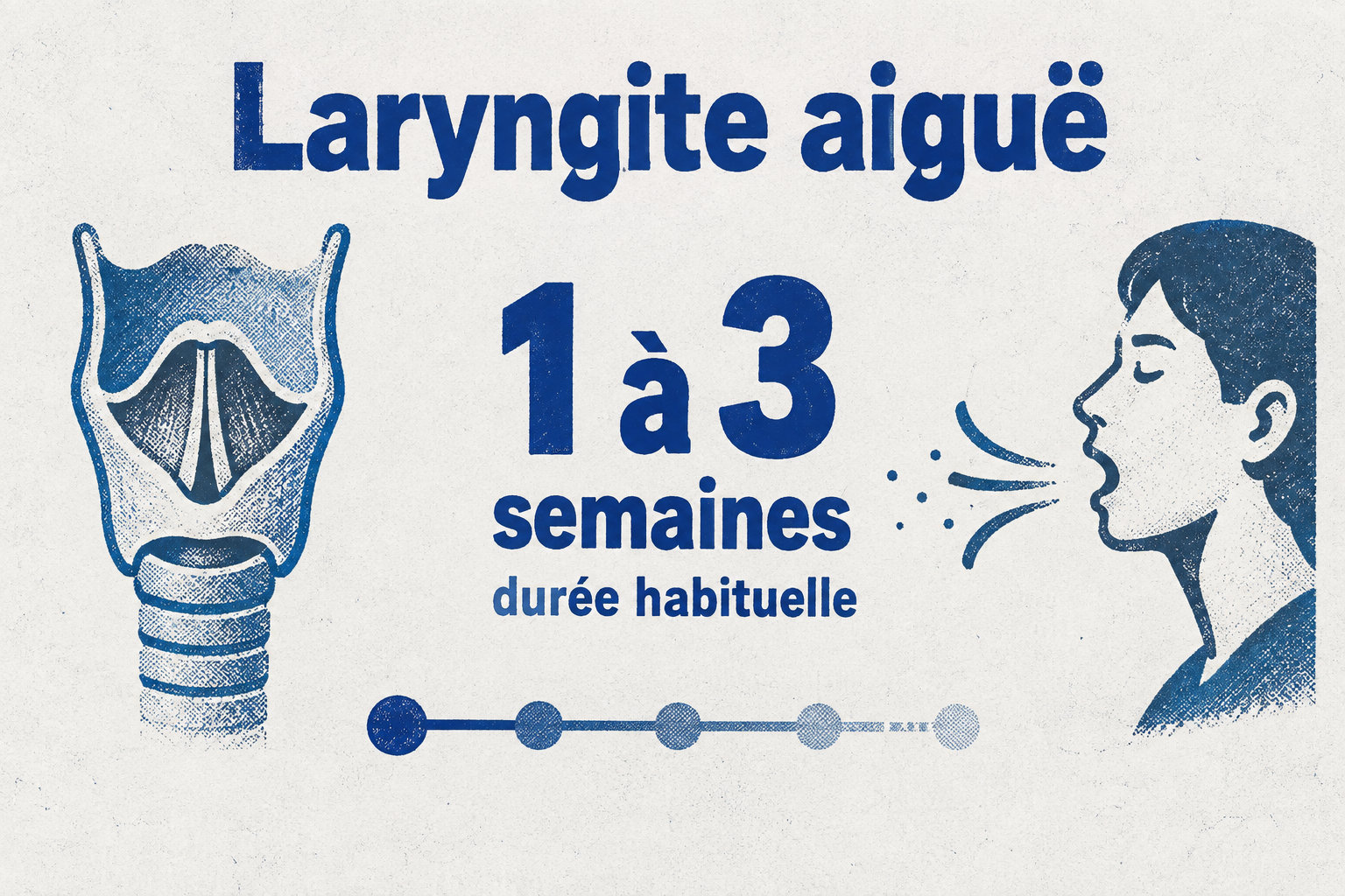 La durée habituelle d’une laryngite aiguë est de 1 à 3 semaines, avec une amélioration progressive des symptômes.
